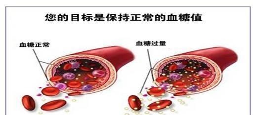 并发症|内分科主任 糖尿病很怕这6种蔬菜, 糖友多吃点！