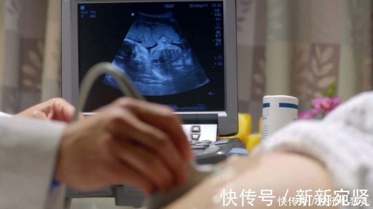 着床|怀孕B超检查太早没意义，太晚又天天担心，而这个孕周刚好！