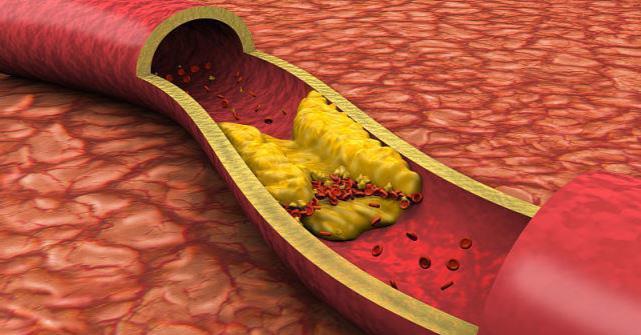 血管|每天吃苹果能降血脂吗北大教授大错特错，真正降血脂的是一事