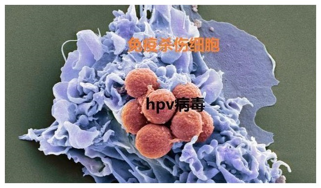 宫颈|身体这几处长“疙瘩”，或是感染HPV，医生女性做2事，护宫颈