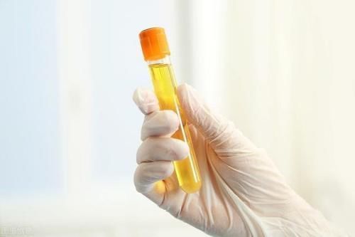 糖尿病足|糖尿病恶化了,身体会出现哪些表现?应注意什么?