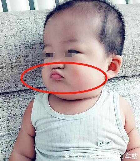 小高|2岁儿子总喜欢“嘟嘴”,外婆看到后立马送去医院,医生:来晚了