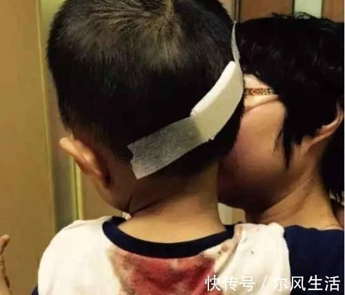 抢救|又一个孩子因它而忘, 这救命的“良方”家长赶紧学起来