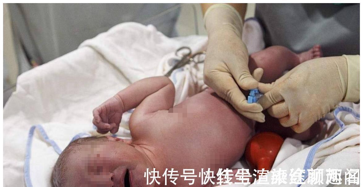 产妇|剪断脐带时,你了解孩子有多疼吗?说出来你都不一定会信