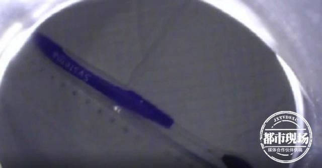 牙刷|20厘米长17岁少年刷牙时吞掉它，医生20多年来第一次见