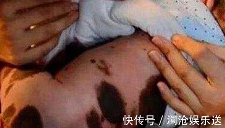 后生|孕妇十月怀胎后生下个“藏獒”,医生得知原因后,怒斥孕妇没人性