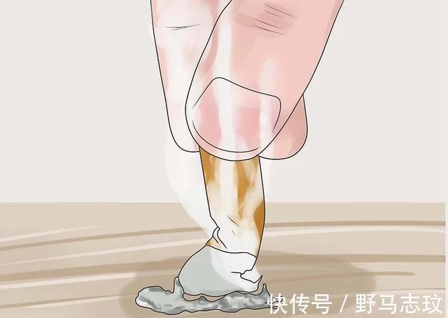 营养均衡|糖尿病腿上出现这种感觉，小心周围神经病变！5个方法可改善