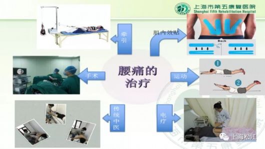 治疗|你了解脊椎压缩性骨折吗？如何治疗？松江医生来解答