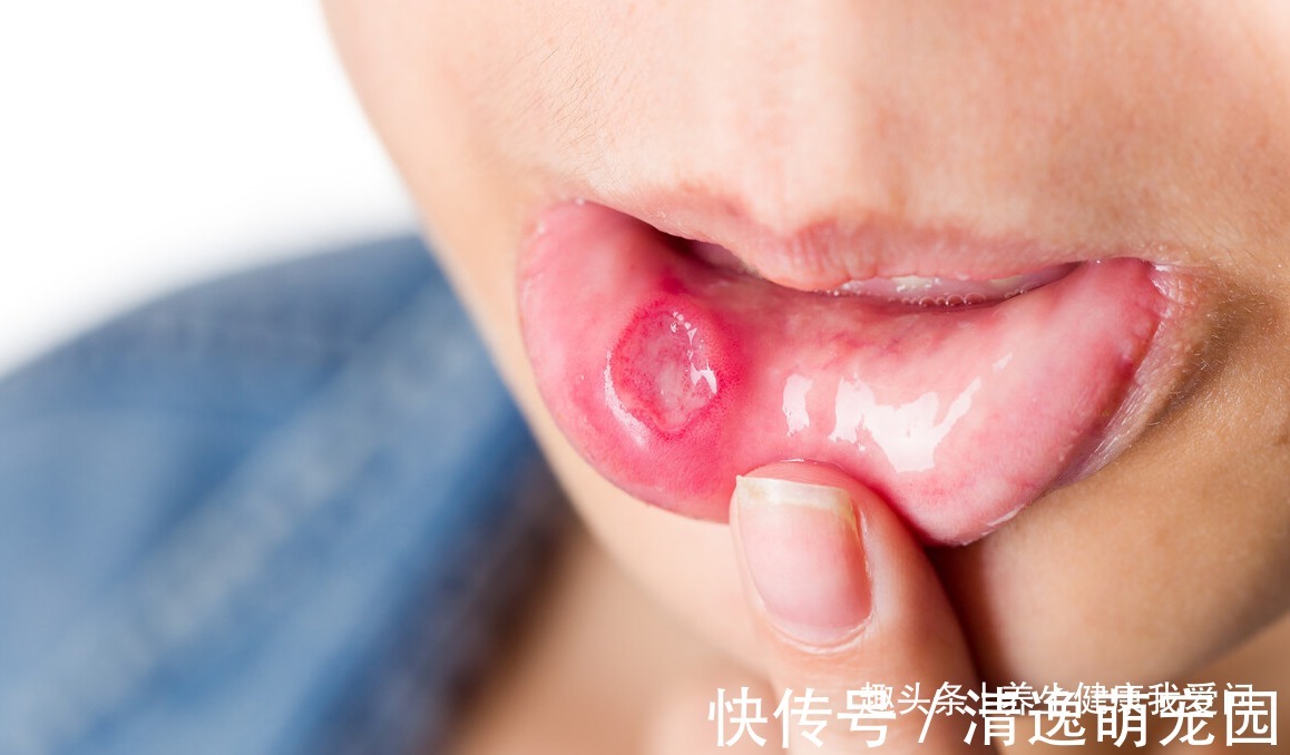 上火|上热下寒、心肾不交!三个调养法,疏通淤堵,调和气血,平衡阴阳