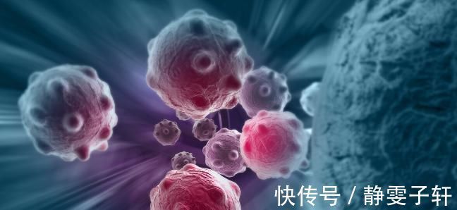 黄疸|一朝得癌,终身抗癌!但是,癌王让你根本没时间抵抗