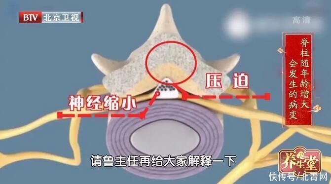 锻炼|人老先老“背”一定不能忽视锻炼后背的肌肉
