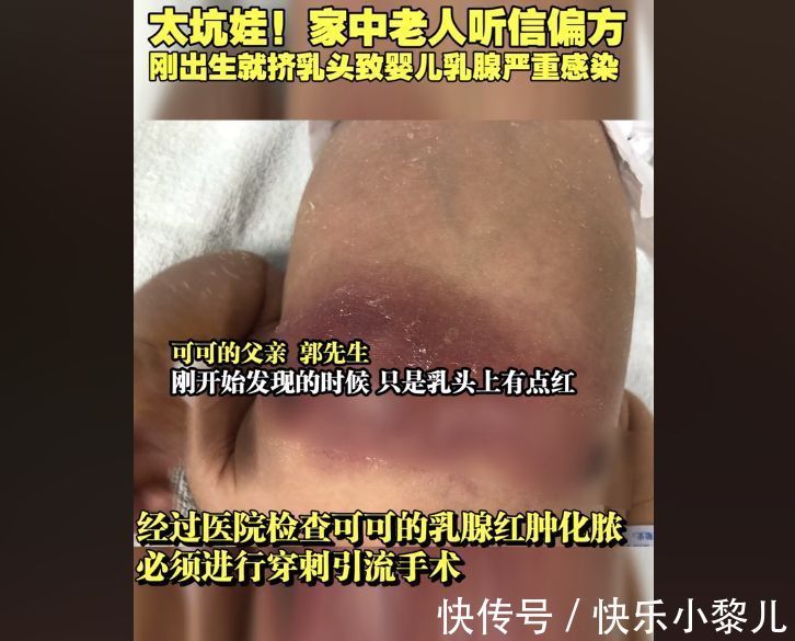医院|新生儿的六种“异常”症状,会自然变好,妈妈别惊慌更无需上医院