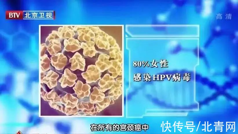 本草纲目|1/6的癌症都是炎症引起的！4类“促炎”饮食，让身体炎症越来越高发！别再吃错了