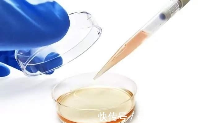 肾病|未来可期丨15例临床案例证实干细胞移植疗法对糖尿病肾病的潜力