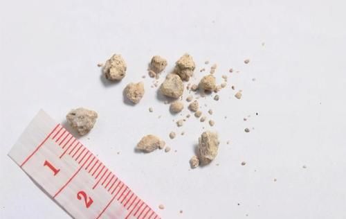 惊蛰将至，少食一味，多吃二果，预防三种疾病，年年健康少生病