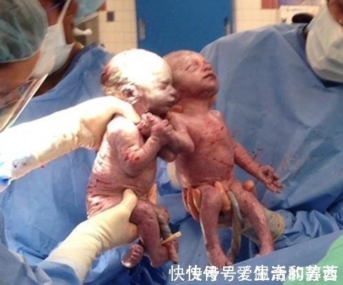 小宝宝|产妇抱着刚断气的新生儿不撒手, 嚎啕大哭, 突然感觉不对劲!