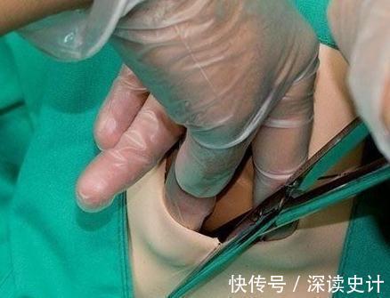 疼痛|顺产带来这么多疼痛,为什么还有人选择,顺产的好处你该了解的