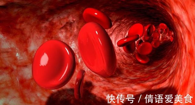 饱和脂肪酸|血脂高不高,看头就懂,若没有出现这3大症状,你就知足吧