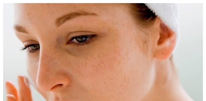 黑眼圈|女性有没有妇科病,看脸就知道!希望你没有这4个表现!