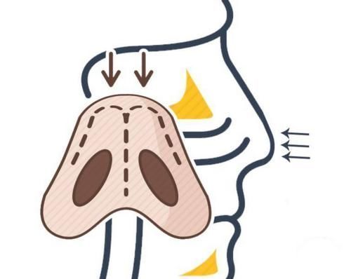 口腔溃疡|一睡觉就流口水,说明什么问题?看完这4点,或许你就明白