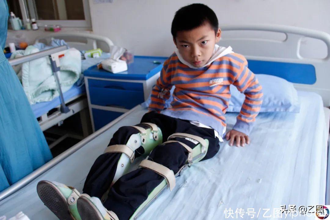 治疗|漂亮妈妈怀孕7个月乘坐公交，路上颠簸引发悲剧：幸福被我毁了