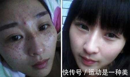 斑点 药店有一种司空见惯的面霜,被当作“香馍馍”,用后斑点慢慢消失!