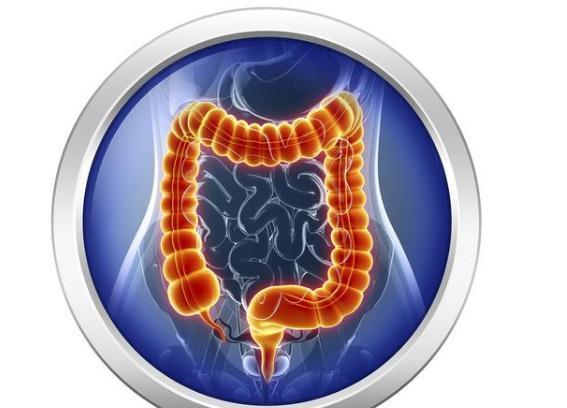 息肉|直径5毫米的肠息肉,变成肠癌要多长时间?是不是割掉就没事了?