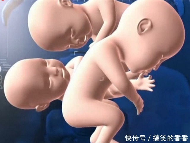 孕妇|孕妇怀四胞胎以为是儿子,结果生四个女儿,爸爸产房外手舞足蹈