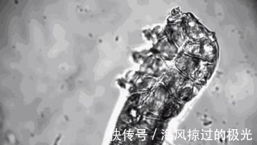 泡沫|看到黑头就想挤担心越挤越多！网上3种方法才损伤皮肤，要避开