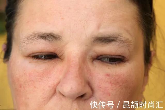 糖尿病|糖尿病人，若没出现5个症状，血糖控制得不错，并发症离你还很远