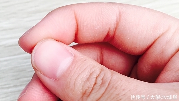 为什么有些人手指甲上有月牙,有些人没有?是怎么回事?