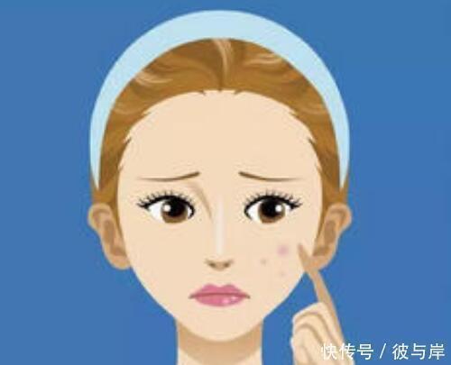 痘痘|比痘痘更可怕的是痘印,去痘印真的那么难很多人没用对方法