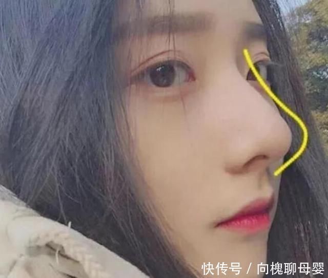 枕套|鼻子上总是挤出“白色条状物”学会这3招,和“草莓鼻”说拜拜