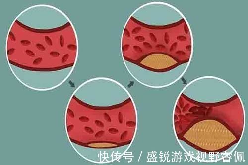 合成|“高胆固醇”美食,鸡蛋也在其中,榜首却很少有人知道,还在吃