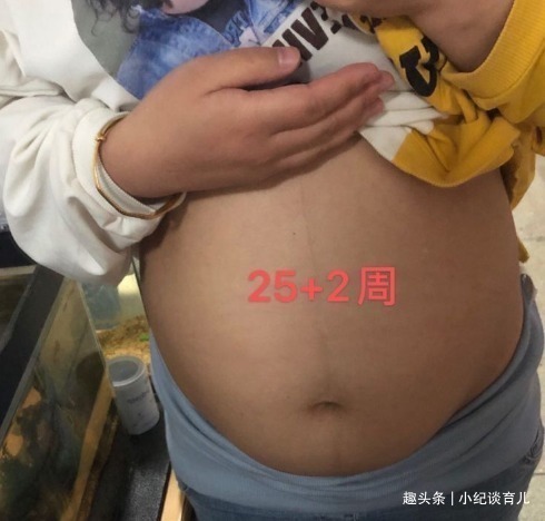 畸形|通过了四维彩超,准妈妈却被甄别畸形,这是什么原因