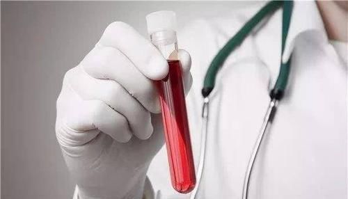 高血脂|吃什么可以“软化血管”有效的办法就一个,其他都是“忽悠”你