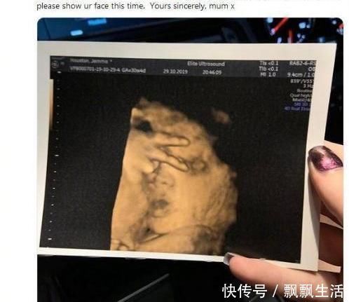 淘气|胎儿性格隔着肚皮能看出来吗？孕期欢脱的胎儿，出生后也多调皮