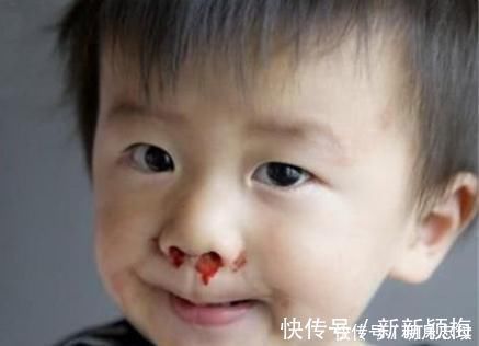 出血性疾病|白血病多“青睐”儿童?不论男女,身体若有这“3表现”,要及时就医!