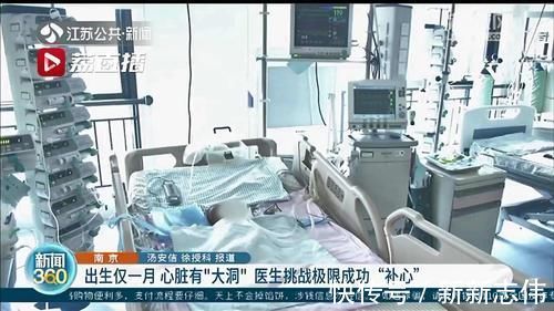 切口|一个月大的婴儿心脏查出有个“大洞”医生挑战极限成功“补心”
