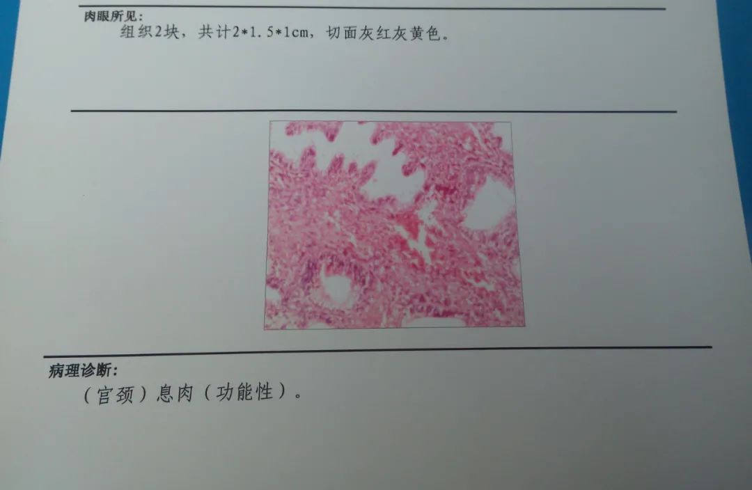 囊肿|一切息肉与囊肿，用这个4味药的中医方子，可去死肌，蚀恶肉