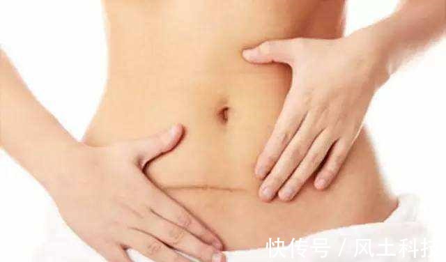 宫内孕|明明是宫内孕,为什么医生说不能要古代女性却没有这个烦恼!