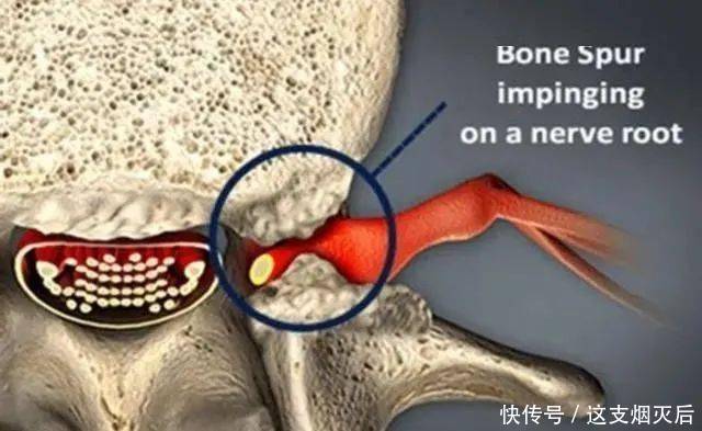  手部麻木的7种常见病因、如何鉴别及治疗