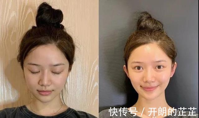 女演员|中国女性荣升世界第一,在整容数量上