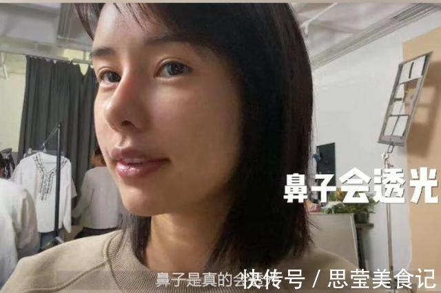 张轻轻|美女模特警告世人谨慎整容，自曝隆鼻后遗症：鼻孔流脓奇臭无比