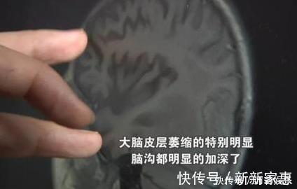 床垫|心疼!4岁女童成植物人,这种危险物件很多家长都爱用!