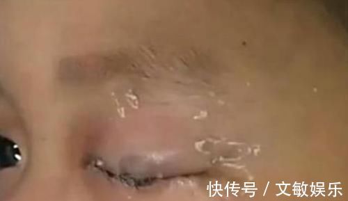 医生|8岁儿子误把502胶水滴进眼睛里，聪明宝爸的这一举动，让医生叫好