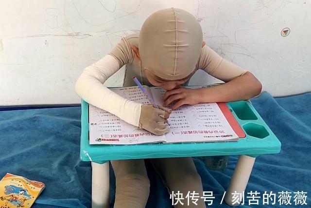 太阳能|热水器老化爆裂烫伤6岁男孩,治疗费已超百万,家长始终不愿放弃