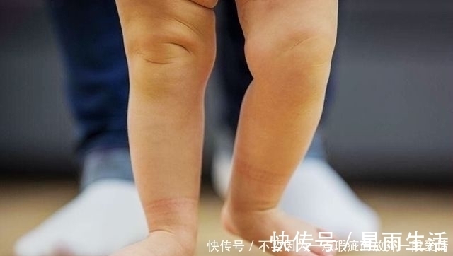 特征|孩子腿部有这2个特征,预示今后是“大长腿”,你家娃是吗?