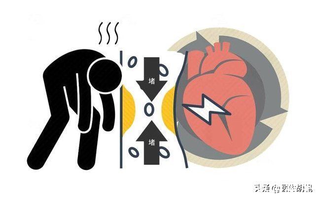 高血脂|如何科学降血脂？4个误区多少人踩过，早知道早避开