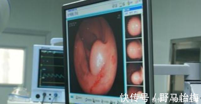 腹泻|胃不好的人,常吃这几种养胃水果,为了自己的胃部健康,了解一下